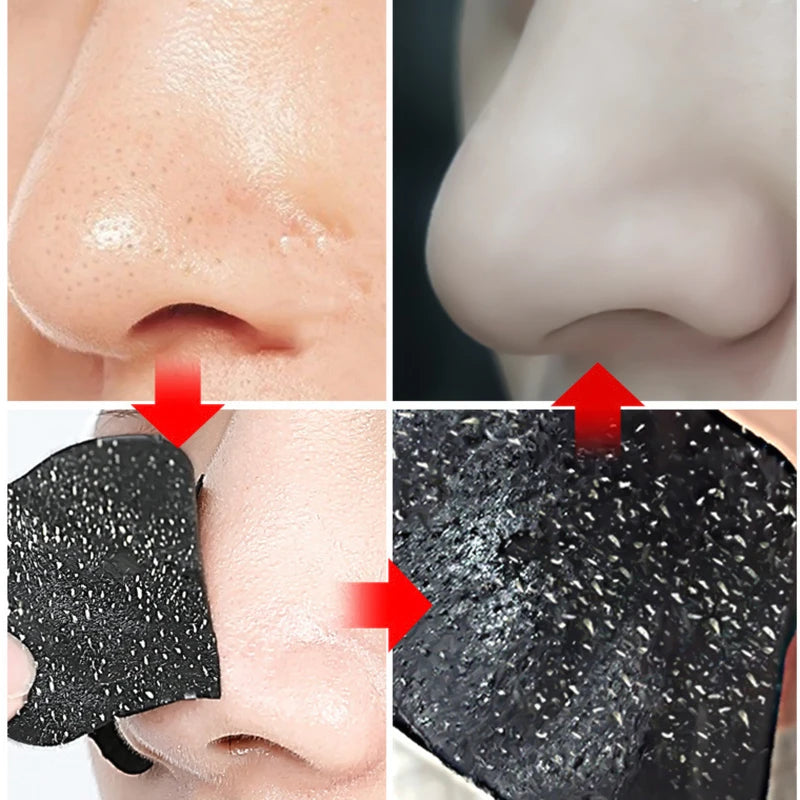 10/20/50pcs Nose Strips for Blackhead Removal & Pore Cleansing – Fast & Effective Solution for Clearer Skin