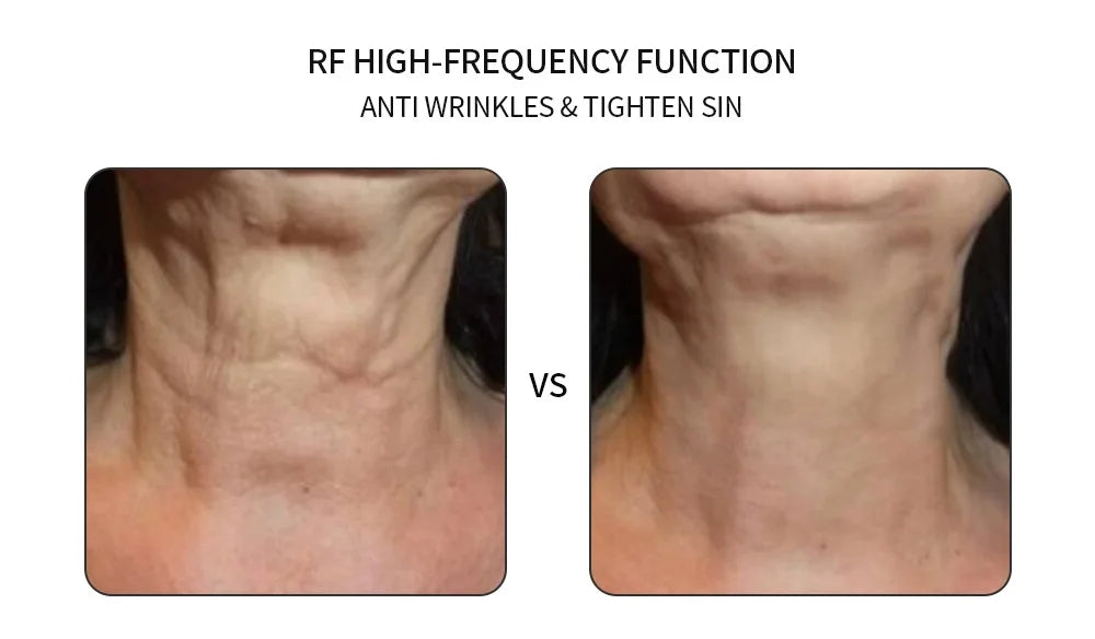 Facial Beauty Device with Photon Electroporation | Advanced EMS Lifting, Deep Skin Tightening & Radiant Rejuvenation Technology