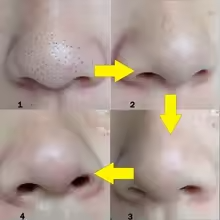 10/20/50pcs Nose Strips for Blackhead Removal & Pore Cleansing – Fast & Effective Solution for Clearer Skin