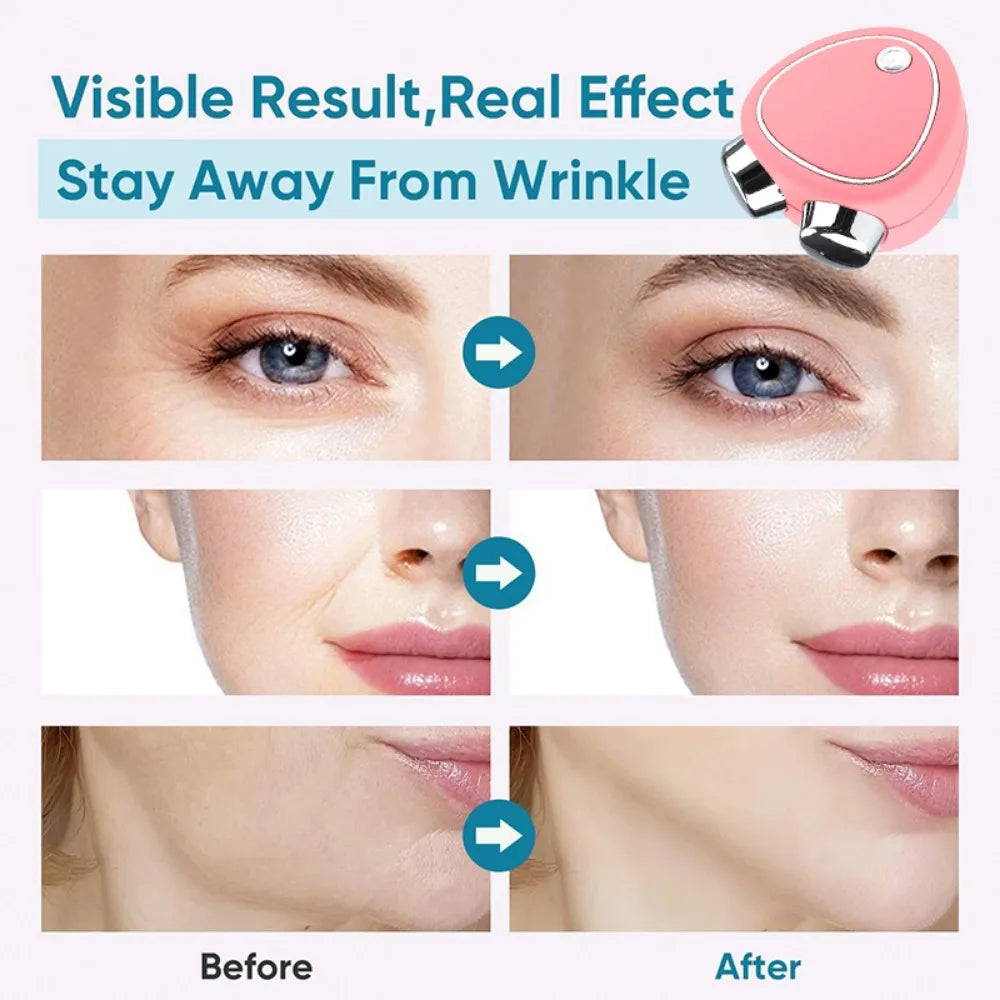 Smart Luxury Skin Lifting & Rejuvenation Device – EMS & Microcurrent Technology for Youthful Radiance