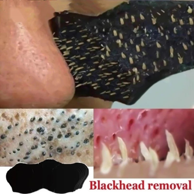 10/20/50pcs Nose Strips for Blackhead Removal & Pore Cleansing – Fast & Effective Solution for Clearer Skin